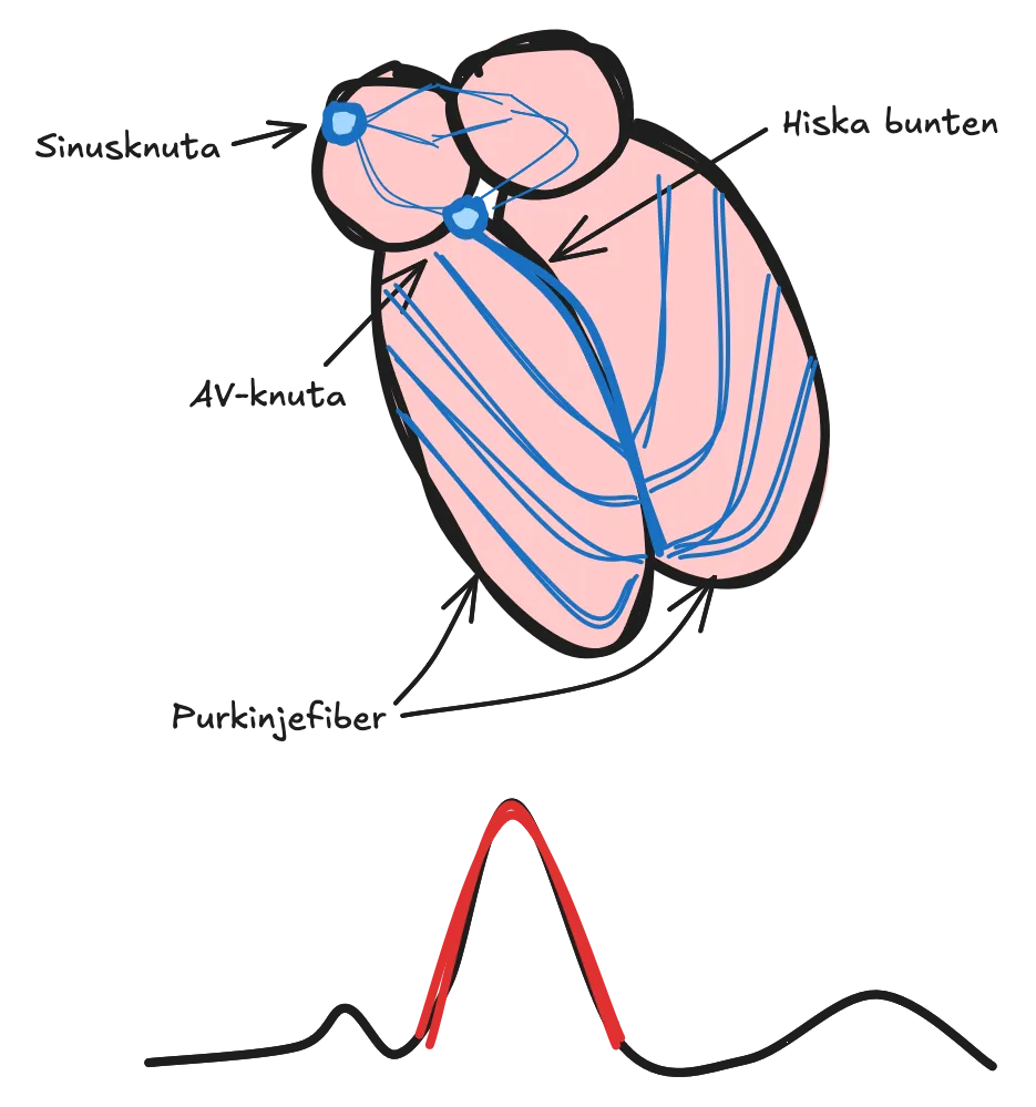 Purkinjefiber