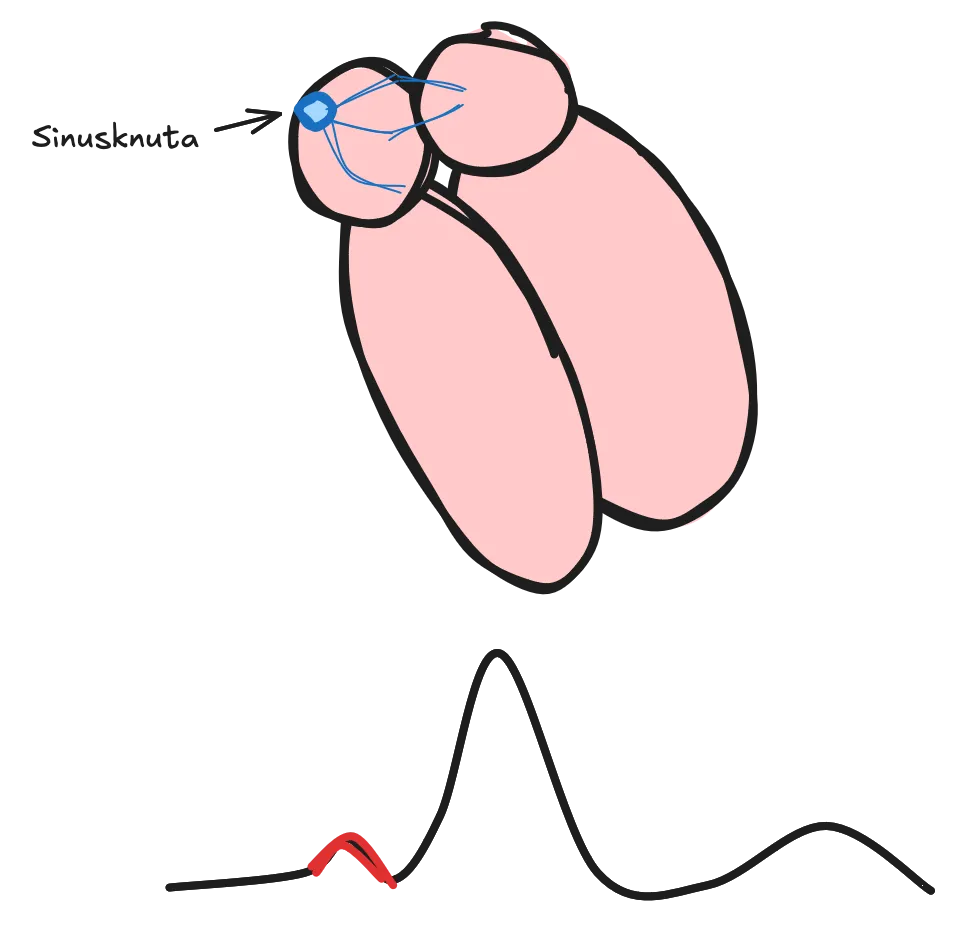 Sinusknutan2